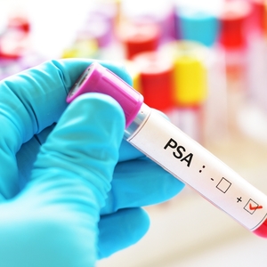 9 Ways to Lower and Manage Cortisol Levels